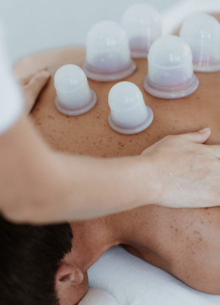 CuppingMassageGloucester